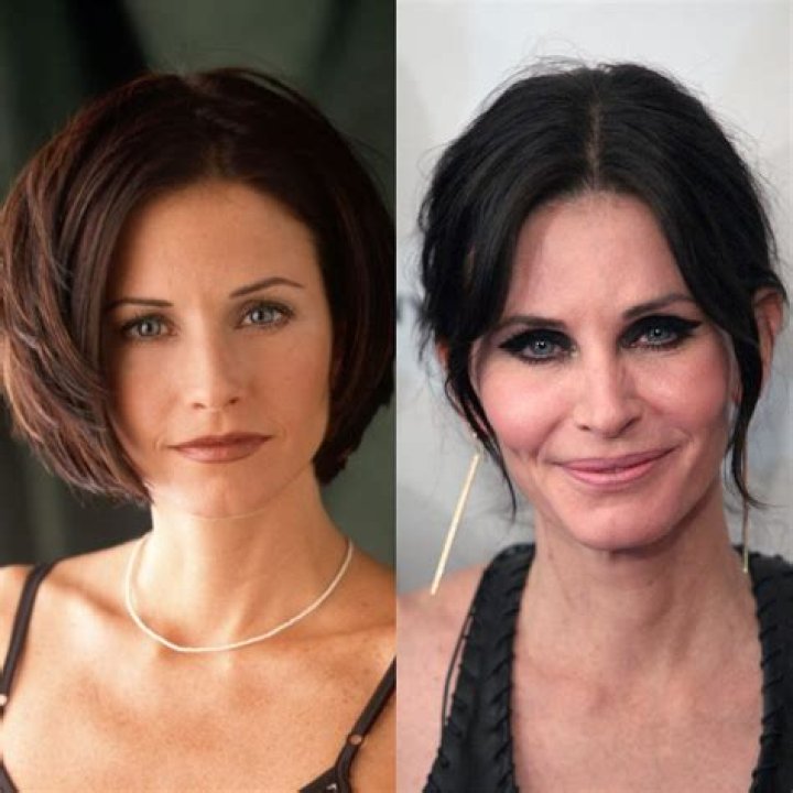 Courteney Cox's Botched Plastic Surgery